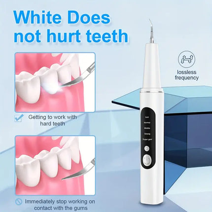 Rechargeable Teeth Scaler with LED Light – Oral Cleaner